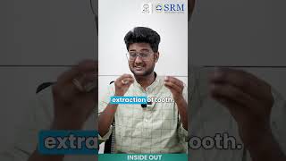 Dry Socket Dilemma  SRM Kattankulathur Dental College amp Hospital  SRMIST [upl. by Milt125]