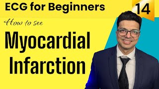 ECG for Beginners  How to see MYOCARDIAL INFARCTION in ECG  जानिए Evolution of MI in ECG [upl. by Suiremed]