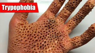 10 Phobias People Actually Have ft Trypophobia Optophobia Arachibutyrophobia amp MORE [upl. by Eduam]