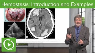 Hemostasis Introduction and Examples  Cellular Pathology [upl. by Ellan]