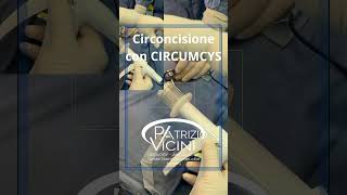 AndrologiaAndrologoCirconcisioneFimosi CircumcysCircumcisionProf Patrizio ViciniRoma [upl. by Hgieloj744]