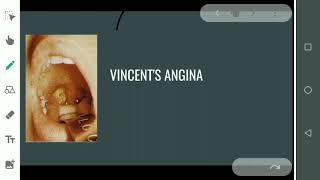 ACUTE NECROTIZING ULCERATIVE GINGIVITISVINCENTS ANGINAsimple and easy [upl. by Ottillia]