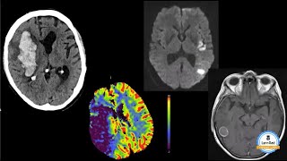 Lernrad Neuroradiologie Basics Kurs  Lust auf Fallbasiertes interaktives Lernen [upl. by Nirak91]