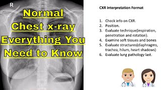 🧑🏽‍⚕️ chest x ray normal Learn The Basics About chest x ray [upl. by Eecal714]