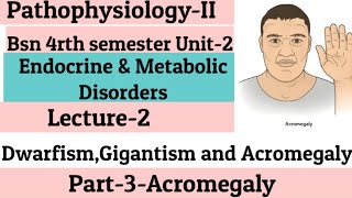 AcromegalyUnit2Endocrine amp Metabolic DisordersLecture2DwarfismGigantism AcromegalyPart3 [upl. by Eelessej]