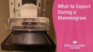 What to Expect During a Mammogram [upl. by Ttsepmet383]