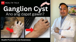 Ganglion Cyst Causes Risk factors Diagnosis Treatment and Prevention [upl. by Stodder]