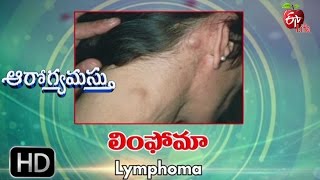 Aarogyamastu  Lymphoma  18th May 2017  ఆరోగ్యమస్తు [upl. by Nivram742]