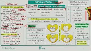 Obstetricia  Parto Distocico 1 [upl. by Monk319]