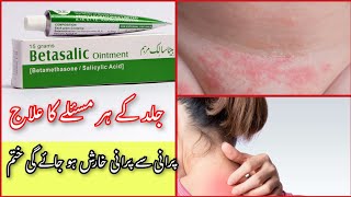 Betasalic ointment review  Betasalic cream ke fayde  How to use betasalic ointment  خارش کا علاج [upl. by Enelrihs614]