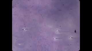 Fascinating lab footage of sperm [upl. by Aubree]