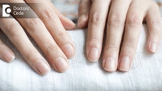 Causes of nails turning white partially or fully  Dr Amee Daxini [upl. by Cown332]