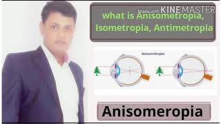 Anisometropia  Isometropia  Antimetropia  Simple  Compound  Mixed anisometropia  treatment [upl. by Enoj]