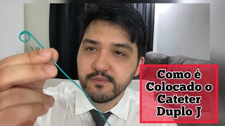 Como é colocado o Duplo J  Video da Cirurgia de colocação do cateter Duplo Jota no rim [upl. by Fleisig]