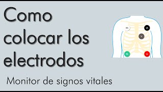 Como colocar los electrodos monitor de signos vitales  video 2 [upl. by Palmore]