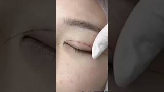 I Tried Double Eyelid Surgery [upl. by Thormora70]