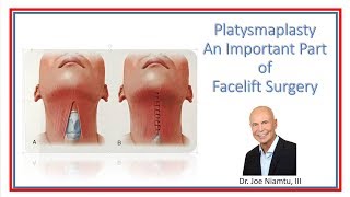 Platysmaplasty A most Important Part of a Facelift [upl. by Jeu29]