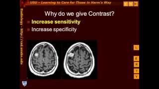 Introduction to Contrast Enhancement [upl. by Oesile42]