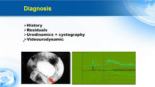 Management of late complications of slings [upl. by Larine]