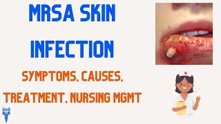 MRSA SKIN INFECTION Causes Symptoms Treatment amp Nursing Management [upl. by Euridice949]