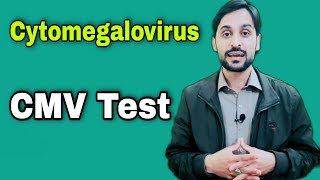 CMV Test  Cytomegalovirus Test [upl. by Decato743]