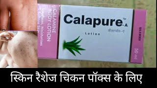 Calapure A lotion uses in Hindi  लोशन एक फ़ायदे अनेक calapure a lotion calapurea [upl. by Hedberg]