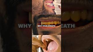 Zuniga on 3 Steps To ELIMINATE Bad Breath [upl. by Akeim]