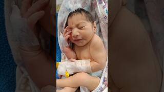 23 kg female child delivered with microcephaly 😍♥️viral shortvideo youtubeshorts [upl. by Busch]