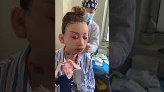 EXTREME Facelift Result  Doctor Reacts [upl. by Anglim]