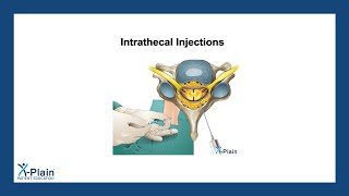 Intrathecal Injections [upl. by Nitza641]