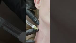 Neck Lines Aesthetic Treatment  Rechelle Trejo Training cosmeticprocedure podcast [upl. by Idet]