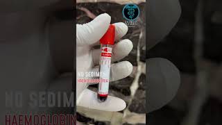 ticks infestation ehrlichia redurine hemoglobinuria dogs like share comment subscribe [upl. by Mikol]