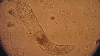 Demodex folliculorum mite under a microscope walking [upl. by Avehsile272]