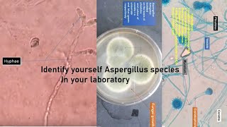 Aspergillus in KOH mount grow on SDA LPCB Preparation showing CondiaConidiophoresPhialides [upl. by Jer124]