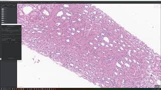 Annotate Glomeruli and Tubules using QuPath and Segment Anything Plugin [upl. by Firman]