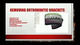 How to Digitally Remove Ortho Brackets [upl. by Leor893]