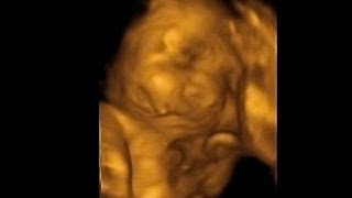 4D Ultrasound of Baby at 29 Weeks  itsJudysLife [upl. by Sunderland]