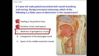 What obstructs the nasopharynx and results in snoring [upl. by Iggie]