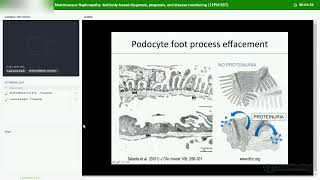 Membranous Nephropathy Antibodybased diagnosis prognosis and disease monitoring [upl. by Sadnac712]