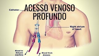 Acesso venoso profundo  Rotina na medicina de emergência [upl. by Krause643]