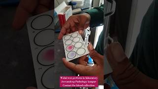 Widal test perform in laboratory by Slide method CBC widal malaria tests shorts viral cbc tests [upl. by Zeb]