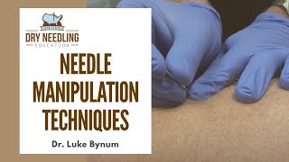 Dry Needling Needle Manipulation Techniques [upl. by Ayidah]