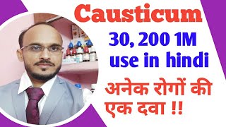 Causticum 30 200 1M use in hindi Causticum homeopathic medicine use amp symptoms causticum for warts [upl. by Nnayd]