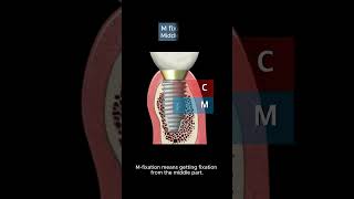 CMI Drilling Protocol 2 [upl. by Lairret]