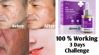 Reduce Black Spots  Acne Pimple MarksIn Just 3 Days  The Derma Kojic Acid Face Serum Review [upl. by Elana141]