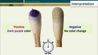 Oxidase Test Five Methods [upl. by Phelgon]