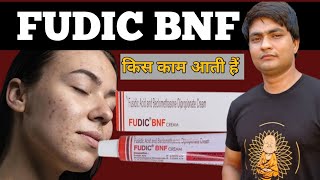 fudic bnf cream benefits  fudic bnf cream uses in hindi  fudic bnf cream [upl. by Ahsilat214]