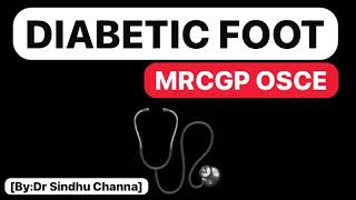 12DIABETIC FOOTMRCGP OSCE [upl. by Goto334]