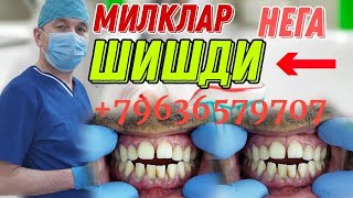 MOSKVADA MILKNI ARZON DAVOLASH STOMATOLOGYIA 79636579707 WHATSAPP [upl. by Tati942]