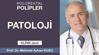 Kolorektal POLİPLER  Patoloji 47 [upl. by Irisa]